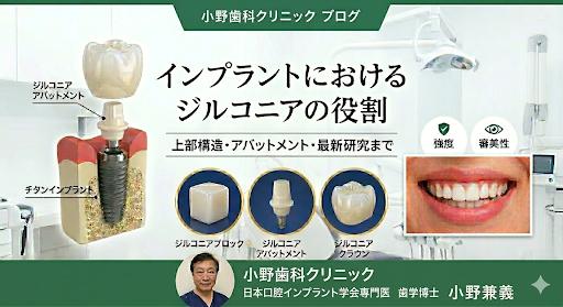 インプラント治療における「ジルコニア」の革新：上部構造からアバットメント，そして未来へ